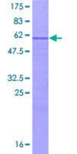 Novus Biologicals Recombinant Human UTP11L GST (N-Term) Protein 10 &mu;g | Buy Online | Novus Biologicals&trade; | Fisher Scientific