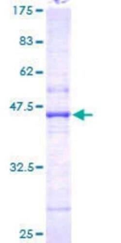 Novus Biologicals Recombinant Human N acetyl transferase 5 GST (N-Term) Protein 25 &mu;g | Buy Online | Novus Biologicals&trade; | Fisher Scientific