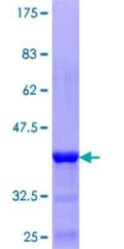 Novus Biologicals Recombinant Human TRIM17 GST (N-Term) Protein 25 &mu;g | Buy Online | Novus Biologicals&trade; | Fisher Scientific