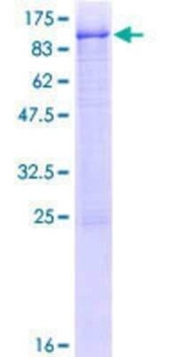 Novus Biologicals Recombinant Human RNF12 GST (N-Term) Protein 25 &mu;g | Buy Online | Novus Biologicals&trade; | Fisher Scientific