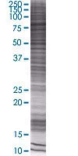 Novus Biologicals RNF12 293T Cell Transient Overexpression Lysate 0.1 mL | Buy Online | Novus Biologicals&trade; | Fisher Scientific