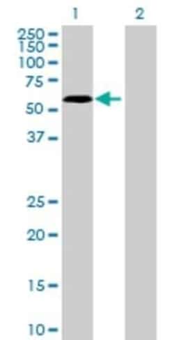 Novus Biologicals&trade;&nbsp;RNF12 293T Cell Transient Overexpression Lysate