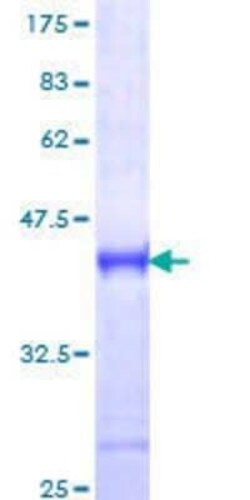 Novus Biologicals Recombinant Human IRAK4 GST (N-Term) Protein 10 &mu;g | Buy Online | Novus Biologicals&trade; | Fisher Scientific