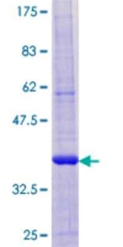 Novus Biologicals Recombinant Human HSD17B12 GST (N-Term) Protein 10 &mu;g | Buy Online | Novus Biologicals&trade; | Fisher Scientific
