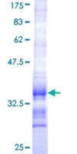 Novus Biologicals Recombinant Human HSD17B12 GST (N-Term) Protein 10 &mu;g | Buy Online | Novus Biologicals&trade; | Fisher Scientific