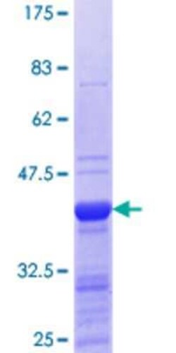Novus Biologicals Recombinant Human ING4 GST (N-Term) Protein 10 &mu;g | Buy Online | Novus Biologicals&trade; | Fisher Scientific