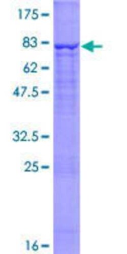 Novus Biologicals Recombinant Human CEECAM1 GST (N-Term) Protein 10 &mu;g | Buy Online | Novus Biologicals&trade; | Fisher Scientific