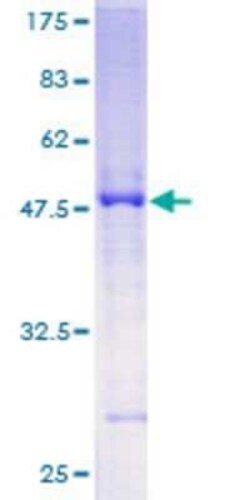 Novus Biologicals Recombinant Human SLC45A2 GST (N-Term) Protein 10 &mu;g | Buy Online | Novus Biologicals&trade; | Fisher Scientific