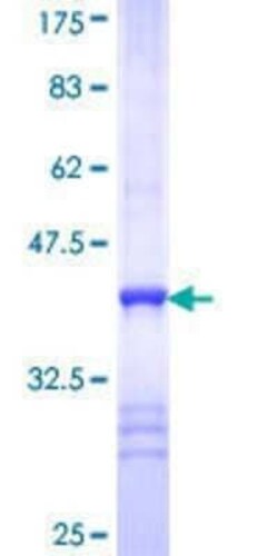 Novus Biologicals Recombinant Human CYB5R4 GST (N-Term) Protein 10 &mu;g | Buy Online | Novus Biologicals&trade; | Fisher Scientific