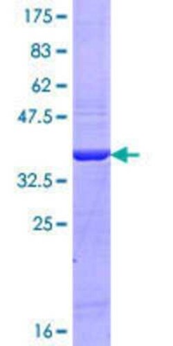 Novus Biologicals Recombinant Human MYO15A GST (N-Term) Protein 25 &mu;g | Buy Online | Novus Biologicals&trade; | Fisher Scientific