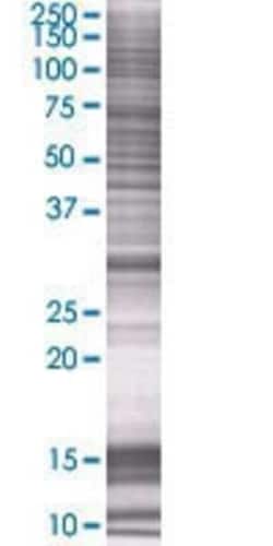 Novus Biologicals hydroxysteroid (17-beta) dehydrogenase 11 293T Cell Transient Overexpression Lysate 0.1 mL | Buy Online | Novus Biologicals&trade; | Fisher Scientific