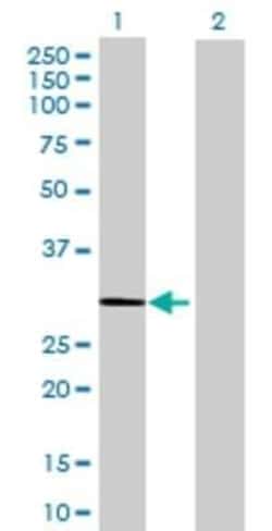 Novus Biologicals hydroxysteroid (17-beta) dehydrogenase 11 293T Cell Transient Overexpression Lysate 0.1 mL | Buy Online | Novus Biologicals&trade; | Fisher Scientific