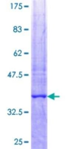 Novus Biologicals Recombinant Human Delta 1 Tubulin GST (N-Term) Protein 25 &mu;g | Buy Online | Novus Biologicals&trade; | Fisher Scientific