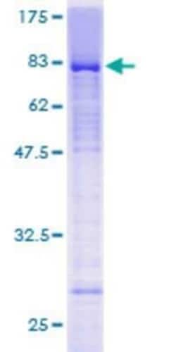 Novus Biologicals Recombinant Human LEF1 GST (N-Term) Protein 25 &mu;g | Buy Online | Novus Biologicals&trade; | Fisher Scientific