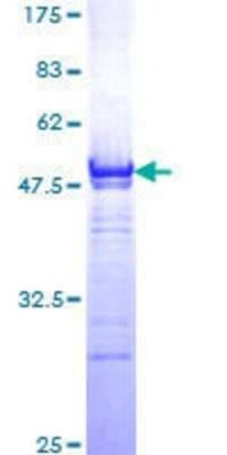Novus Biologicals Recombinant Human LEF1 GST (N-Term) Protein 25 &mu;g | Buy Online | Novus Biologicals&trade; | Fisher Scientific
