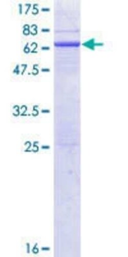 Novus Biologicals Recombinant Human HAO2 GST (N-Term) Protein 10 &mu;g | Buy Online | Novus Biologicals&trade; | Fisher Scientific