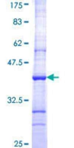 Novus Biologicals Recombinant Human CRBN GST (N-Term) Protein 25 &mu;g | Buy Online | Novus Biologicals&trade; | Fisher Scientific