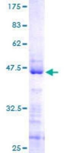 Novus Biologicals Recombinant Human RPL24/RLP24 GST (N-Term) Protein 10 &mu;g | Buy Online | Novus Biologicals&trade; | Fisher Scientific