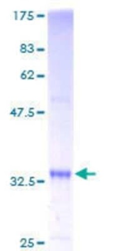 Novus Biologicals Recombinant Human SS18L2 GST (N-Term) Protein 25 &mu;g | Buy Online | Novus Biologicals&trade; | Fisher Scientific