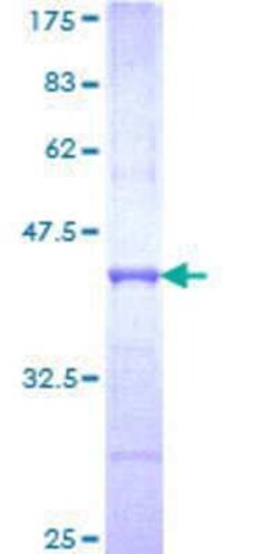 Novus Biologicals Recombinant Human RAPGEFL1 GST (N-Term) Protein 10 &mu;g | Buy Online | Novus Biologicals&trade; | Fisher Scientific