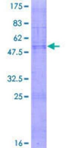 Novus Biologicals Recombinant Human Claudin-18 GST (N-Term) Protein 2 &mu;g | Buy Online | Novus Biologicals&trade; | Fisher Scientific