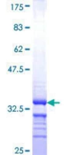 Novus Biologicals Recombinant Human Claudin-18 GST (N-Term) Protein 25 &mu;g | Buy Online | Novus Biologicals&trade; | Fisher Scientific