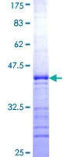 Novus Biologicals Recombinant Human RAB9B GST (N-Term) Protein 25 &mu;g | Buy Online | Novus Biologicals&trade; | Fisher Scientific