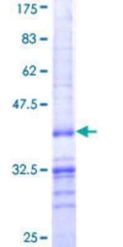 Novus Biologicals Recombinant Human Zfp219 GST (N-Term) Protein 25 &mu;g | Buy Online | Novus Biologicals&trade; | Fisher Scientific