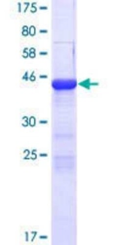 Novus Biologicals Recombinant Human Coatomer protein complex, subunit zeta 2 GST (N-Term) Protein 25 &mu;g | Buy Online | Novus Biologicals&trade; | Fisher Scientific