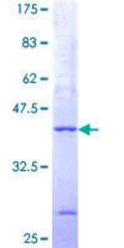 Novus Biologicals Recombinant Human PIGP GST (N-Term) Protein 2 &mu;g | Buy Online | Novus Biologicals&trade; | Fisher Scientific