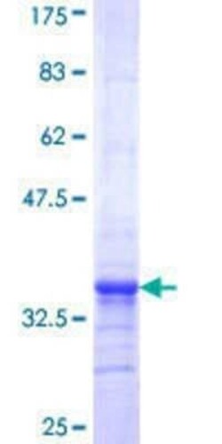 Novus Biologicals Recombinant Human PIGP GST (N-Term) Protein 10 &mu;g | Buy Online | Novus Biologicals&trade; | Fisher Scientific