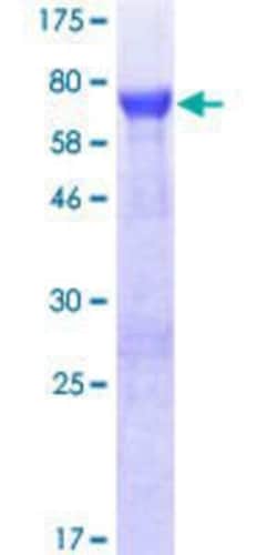 Novus Biologicals Recombinant Human Brp16 GST (N-Term) Protein 10 &mu;g | Buy Online | Novus Biologicals&trade; | Fisher Scientific