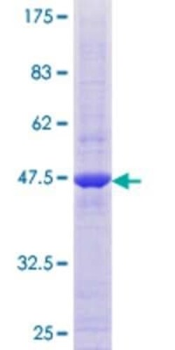 Novus Biologicals Recombinant Human MARCH2 GST (N-Term) Protein 10 &mu;g | Buy Online | Novus Biologicals&trade; | Fisher Scientific