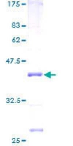 Novus Biologicals Recombinant Human MRPL51 GST (N-Term) Protein 2 &mu;g | Buy Online | Novus Biologicals&trade; | Fisher Scientific