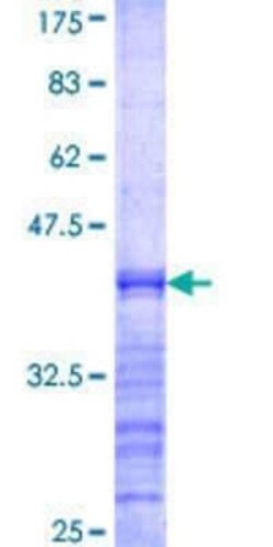 Novus Biologicals Recombinant Human NKIAMRE GST (N-Term) Protein 25 &mu;g | Buy Online | Novus Biologicals&trade; | Fisher Scientific