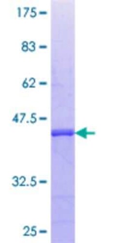 Novus Biologicals Recombinant Human NKIAMRE GST (N-Term) Protein 25 &mu;g | Buy Online | Novus Biologicals&trade; | Fisher Scientific