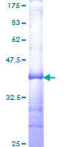 Novus Biologicals Recombinant Human TFDP3 GST (N-Term) Protein 10 &mu;g | Buy Online | Novus Biologicals&trade; | Fisher Scientific