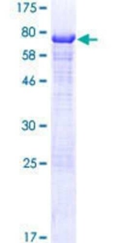 Novus Biologicals Recombinant Human UBAP1 GST (N-Term) Protein 10 &mu;g | Buy Online | Novus Biologicals&trade; | Fisher Scientific