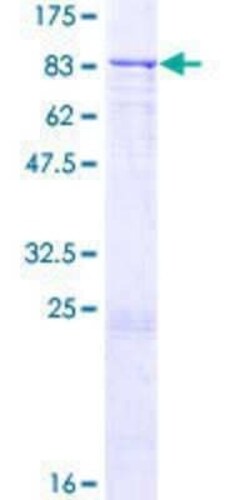 Novus Biologicals Recombinant Human ZNF571 GST (N-Term) Protein 25 &mu;g | Buy Online | Novus Biologicals&trade; | Fisher Scientific