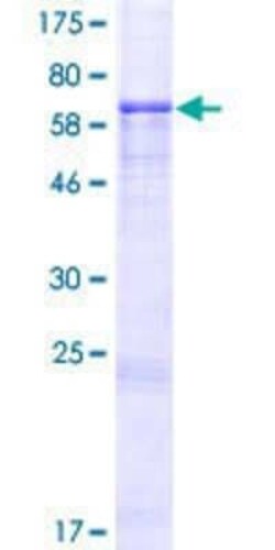 Novus Biologicals Recombinant Human IER5 GST (N-Term) Protein 2 &mu;g | Buy Online | Novus Biologicals&trade; | Fisher Scientific