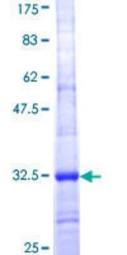 Novus Biologicals Recombinant Human IER5 GST (N-Term) Protein 25 &mu;g | Buy Online | Novus Biologicals&trade; | Fisher Scientific