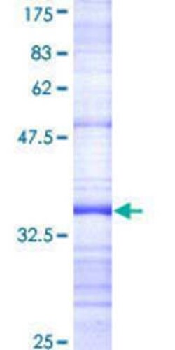 Novus Biologicals Recombinant Human BFAR GST (N-Term) Protein 25 &mu;g | Buy Online | Novus Biologicals&trade; | Fisher Scientific