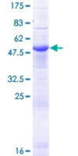 Novus Biologicals Recombinant Human ERGIC2 GST (N-Term) Protein 10 &mu;g:Recombinant
