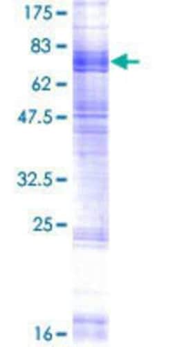 Novus Biologicals Recombinant Human SLC15A3 GST (N-Term) Protein 2 &mu;g | Buy Online | Novus Biologicals&trade; | Fisher Scientific