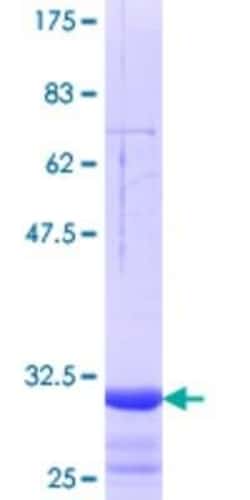 Novus Biologicals Recombinant Human SLC15A3 GST (N-Term) Protein 10 &mu;g | Buy Online | Novus Biologicals&trade; | Fisher Scientific
