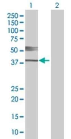 Novus Biologicals THEG 293T Cell Transient Overexpression Lysate 0.1 mL | Buy Online | Novus Biologicals&trade; | Fisher Scientific