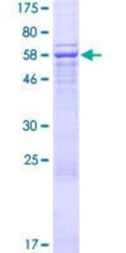 Novus Biologicals Recombinant Human Archaemetzincin 2 GST (N-Term) Protein 25 &mu;g | Buy Online | Novus Biologicals&trade; | Fisher Scientific