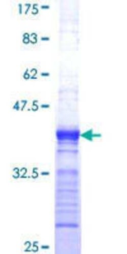 Novus Biologicals Recombinant Human ARL6IP4 GST (N-Term) Protein 10 &mu;g | Buy Online | Novus Biologicals&trade; | Fisher Scientific