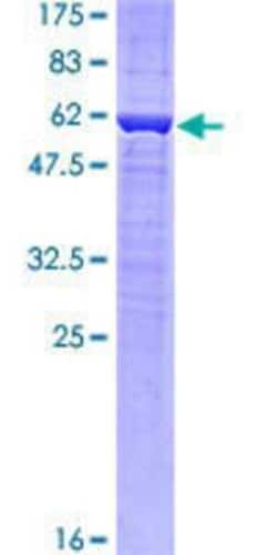 Novus Biologicals Recombinant Human Proline rich 16 GST (N-Term) Protein 10 &mu;g | Buy Online | Novus Biologicals&trade; | Fisher Scientific