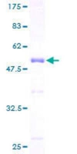 Novus Biologicals Recombinant Human NGRN GST (N-Term) Protein 25 &mu;g | Buy Online | Novus Biologicals&trade; | Fisher Scientific